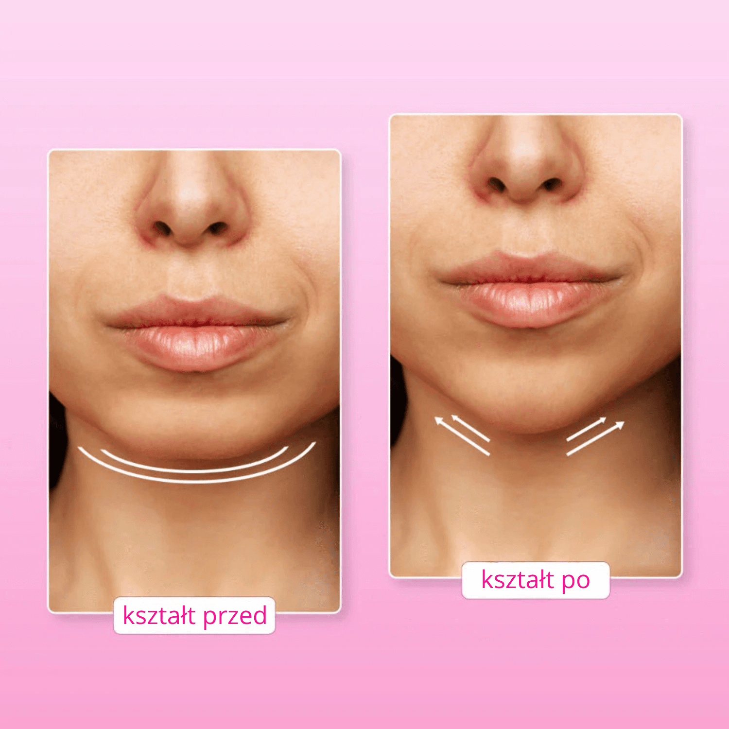 BelleSkin - modelująca opaska do twarzy